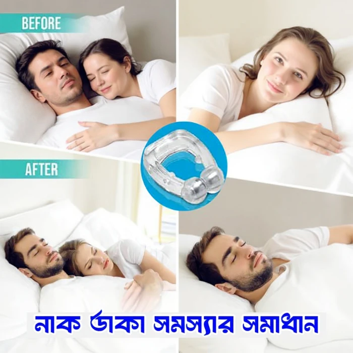 Anti Nose - নাক ডাকা বন্ধ করে