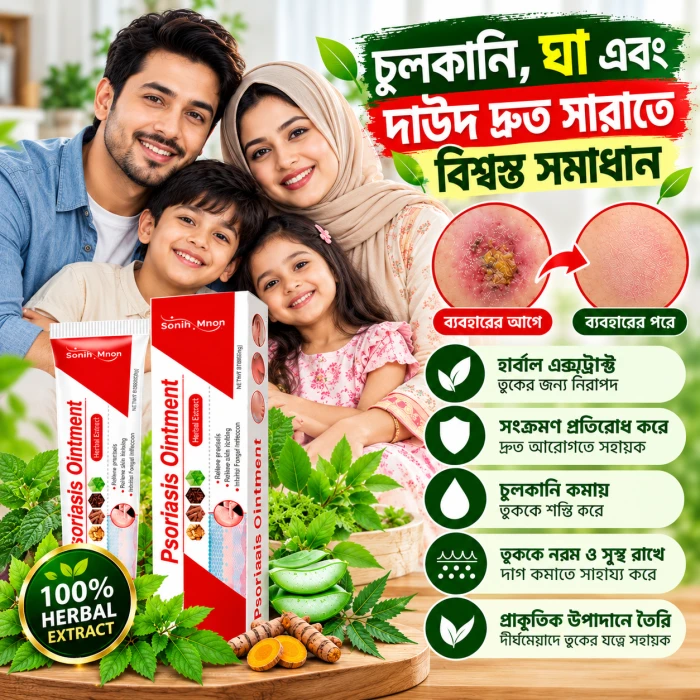 Psoriasis Ointment – চুলকানি ও ত্বকের সমস্যার জন্য অয়েন্টমেন্ট