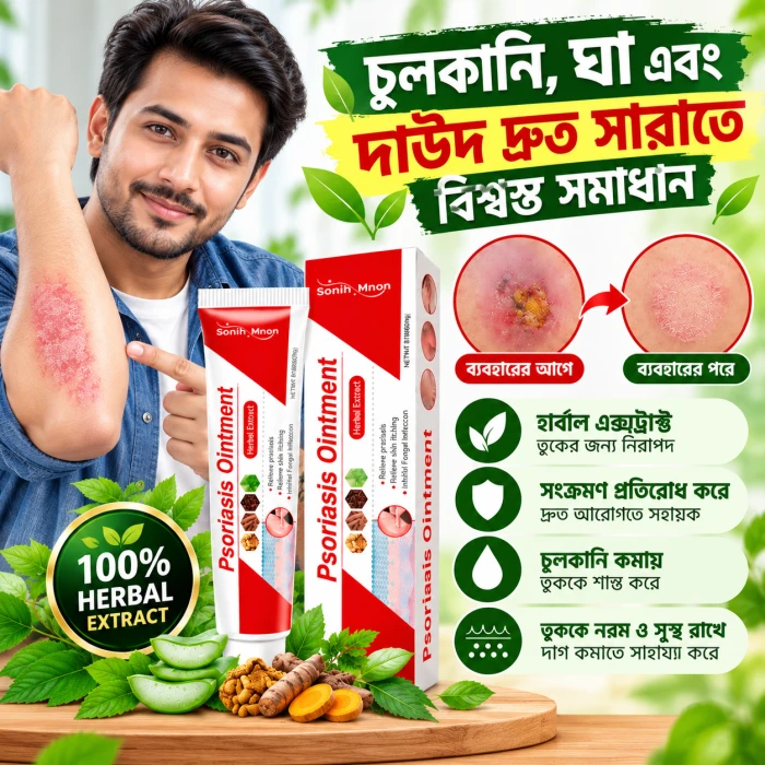 Psoriasis Ointment – চুলকানি ও ত্বকের সমস্যার জন্য অয়েন্টমেন্ট