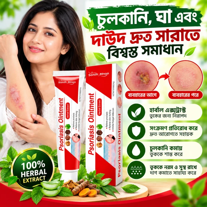 Psoriasis Ointment – চুলকানি ও ত্বকের সমস্যার জন্য অয়েন্টমেন্ট