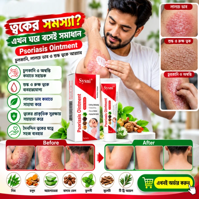 Psoriasis Ointment – চুলকানি ও ত্বকের সমস্যার জন্য অয়েন্টমেন্ট